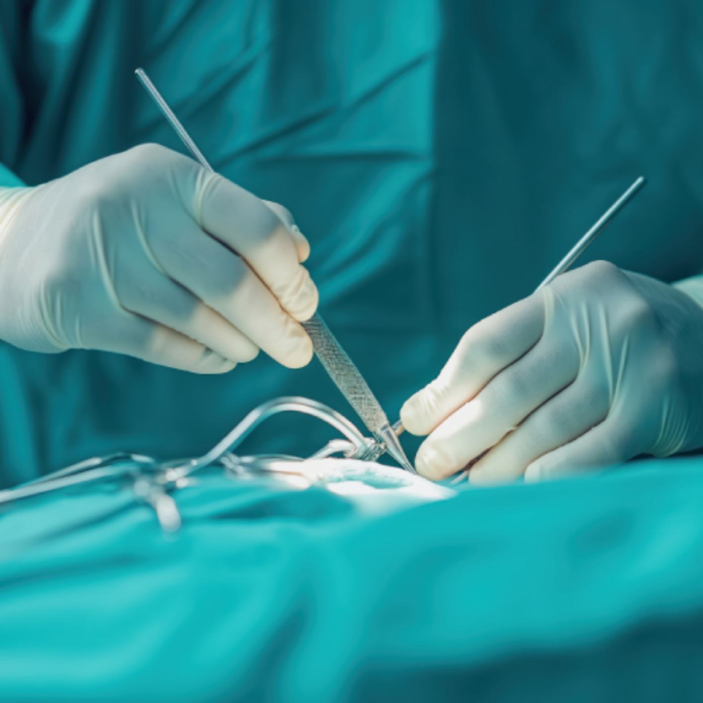 Cirujano para colecistectomía Querétaro